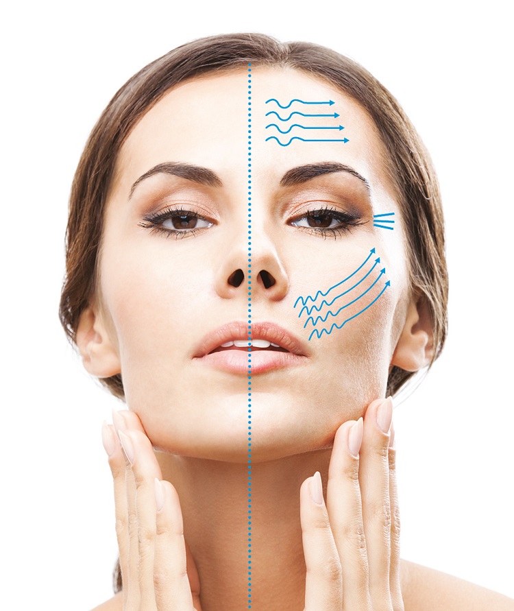 کاربردهای هایفوتراپی برای جوانسازی و زیبایی پوست صورت و بدن

