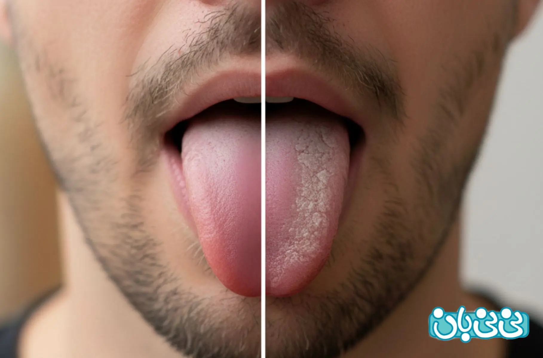 تشخیص بیماری از روی بافت زبان