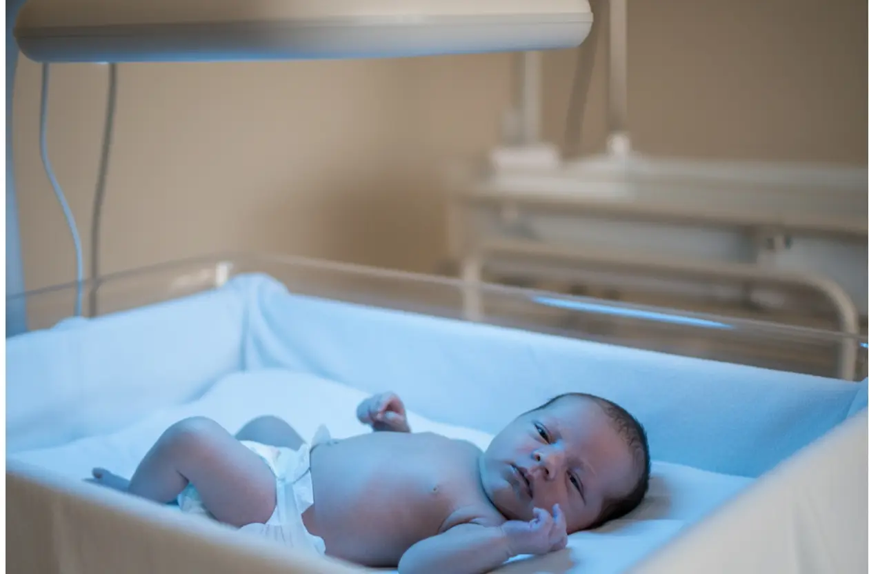 رنگ مدفوع نوزاد زیر دستگاه زردی