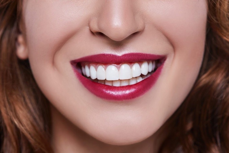 لمینت دندان بدون تراش چه مزایا و معایبی دارد؟
