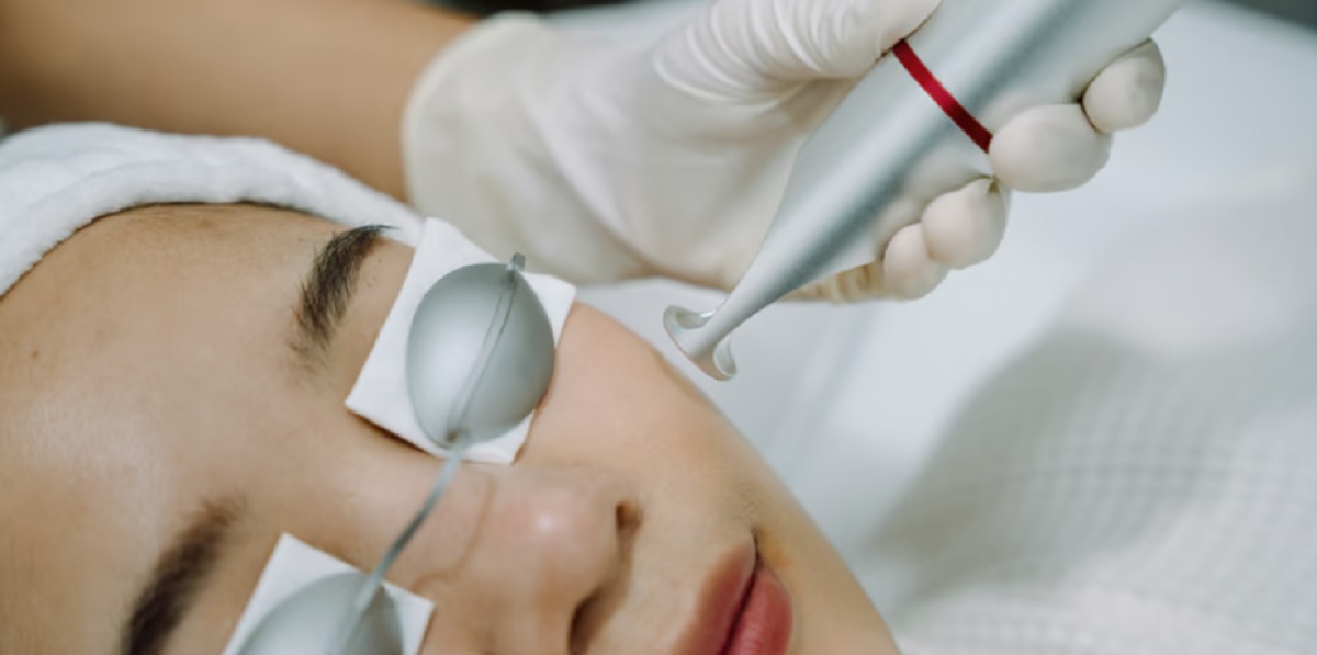 درمان جای جوش صورت با لیزر، بهبودی در کمترین زمان