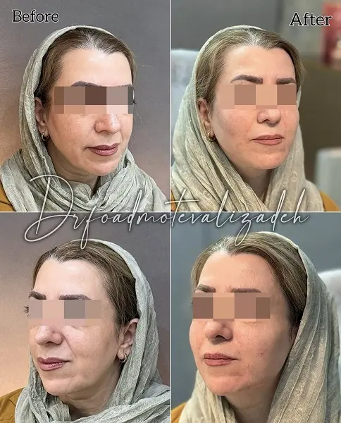 نمونه+جوانساز+نسل+4+دکتر+فواد+متولی+زاده (2)