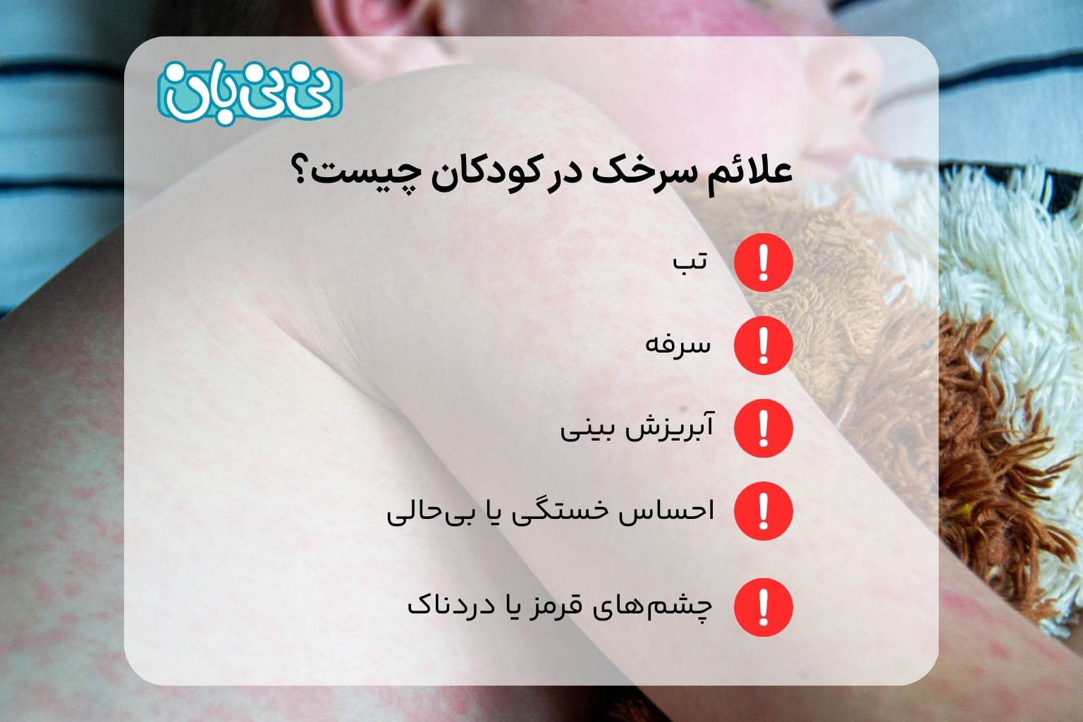 علائم سرخک در کودکان چیست