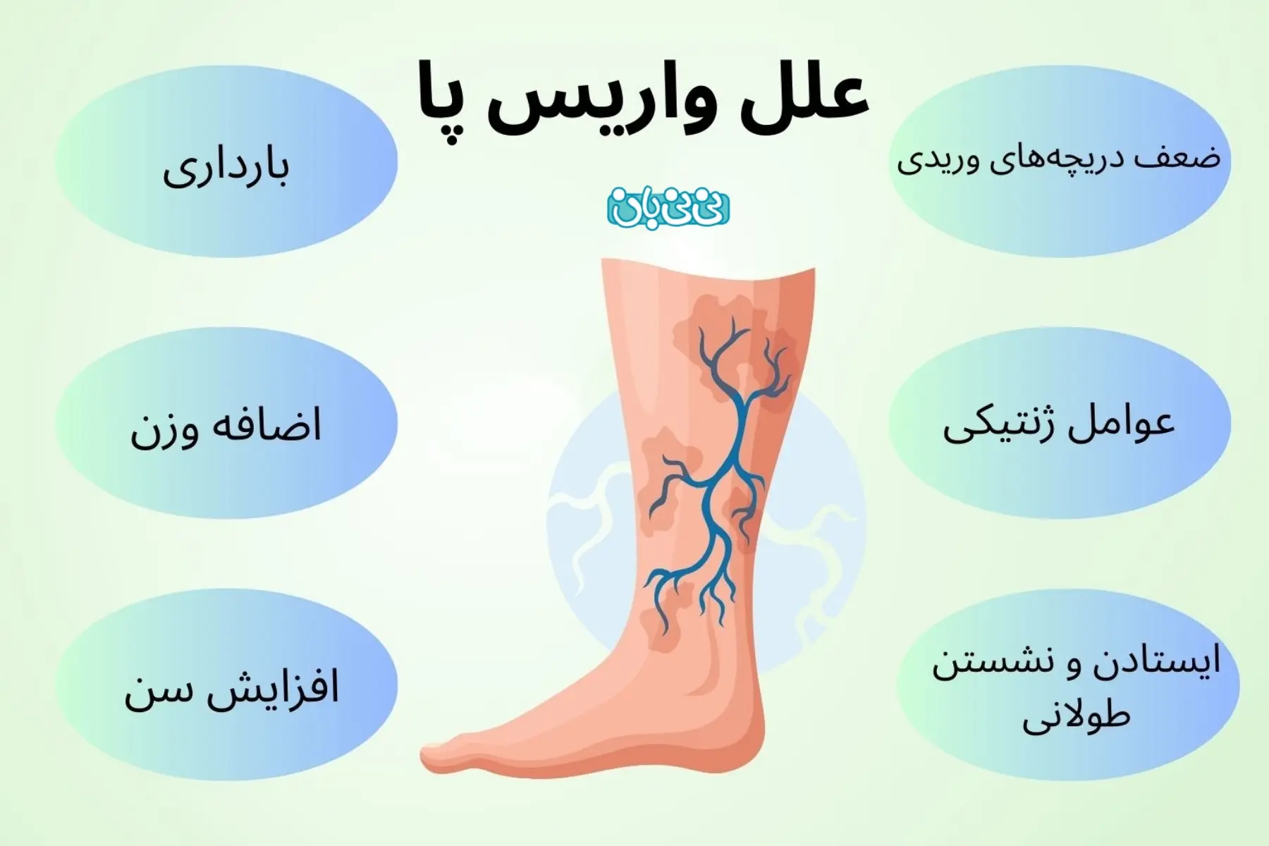 علل واریس پا