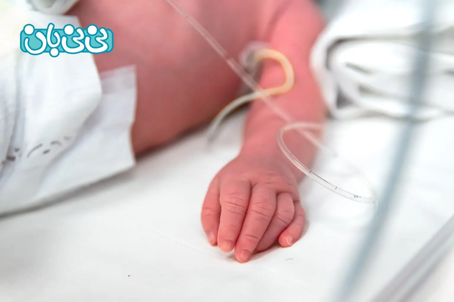 درمان نارس بودن نوزاد چیست