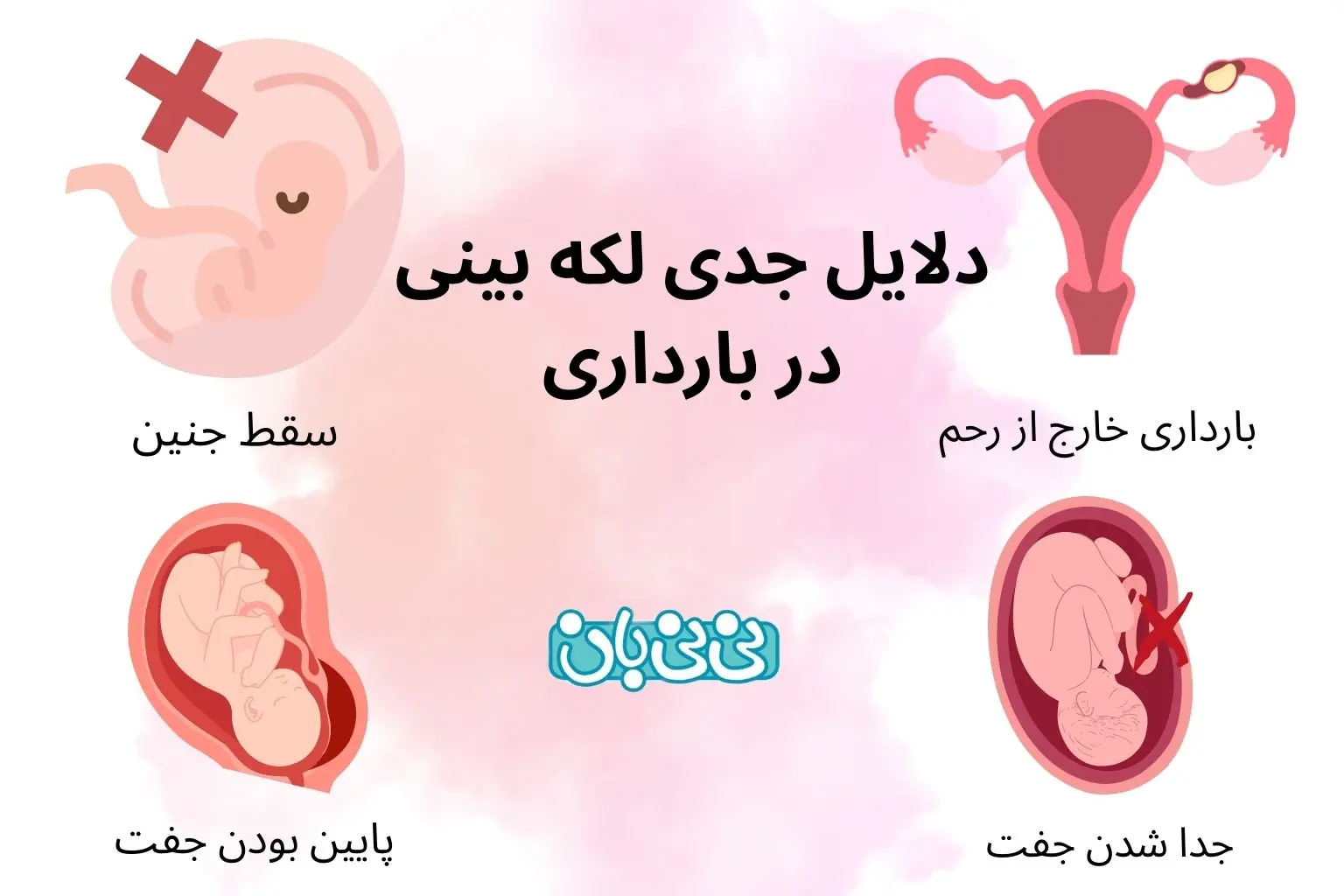 دلایل جدی لکه بینی در بارداری