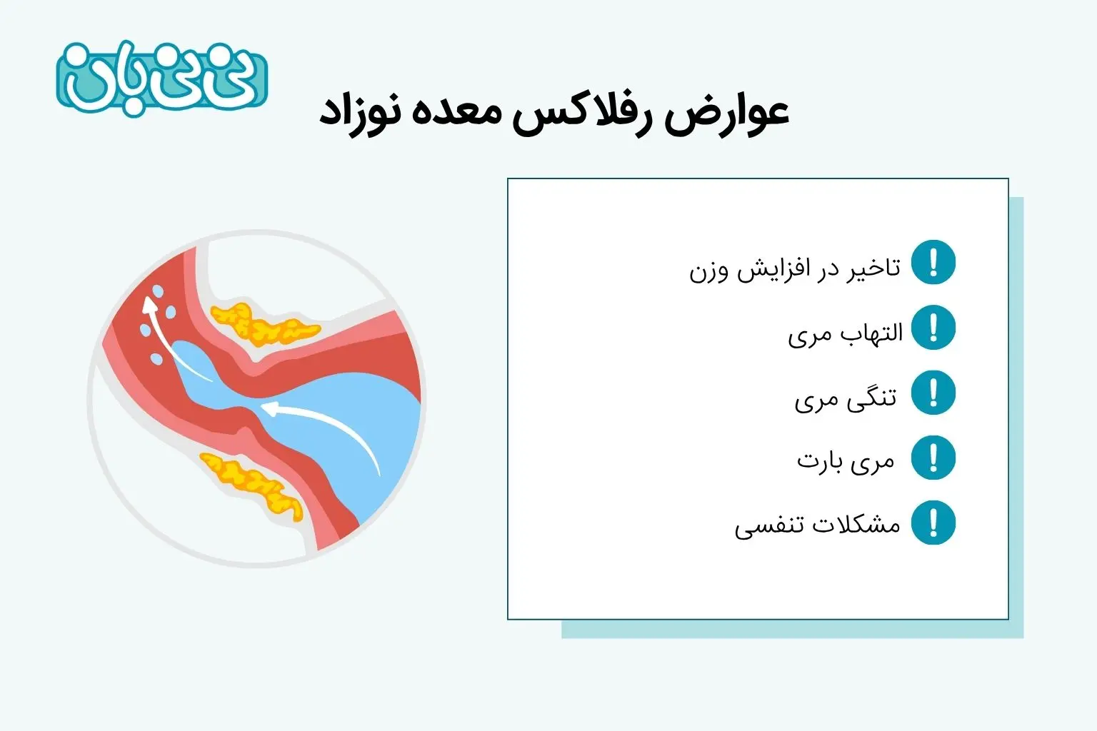 عوارض رفلاکس معده نوزاد 