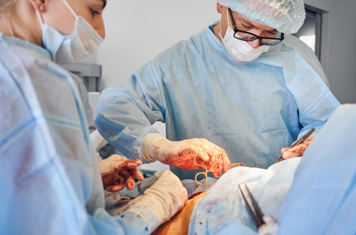 هر آنچه باید درباره جراحی سینه در آقایان (عمل ژنیکوماستی) بدانید