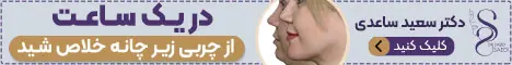 دکتر سعید ساعدی - رندوم