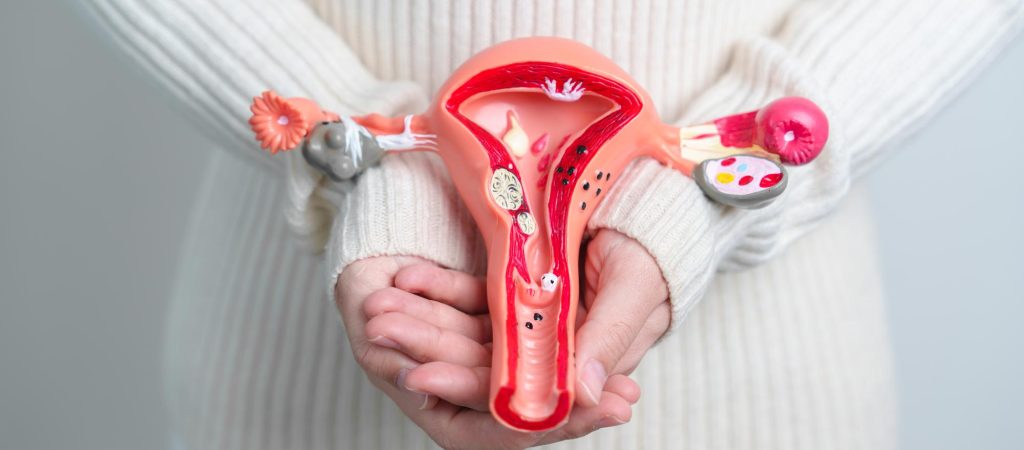 woman-holding-uterus-ovaries-model-ovarian-cervical-cancer-cervix-disorder-endometriosis-hysterectomy-uterine-fibroids-reproductive-system-pregnancy-concept_42256-11352-1024x450