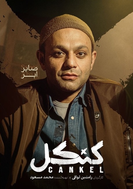 کنکل 