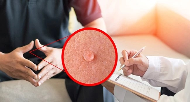 عفونت HPV + علائم و راهکار فوری پیشگیری