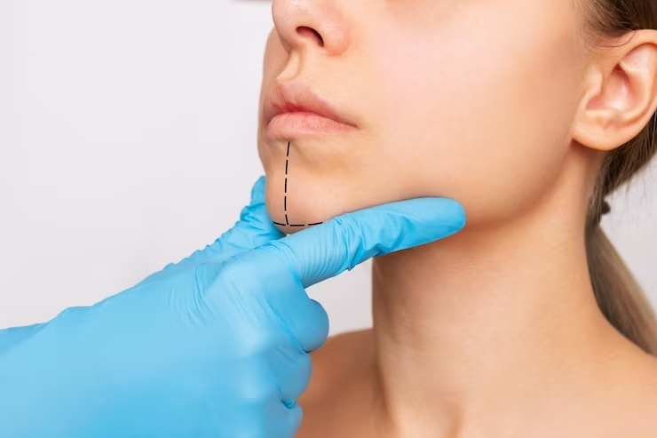 تزریق ژل چانه بهتر است یا پروتز چانه؟