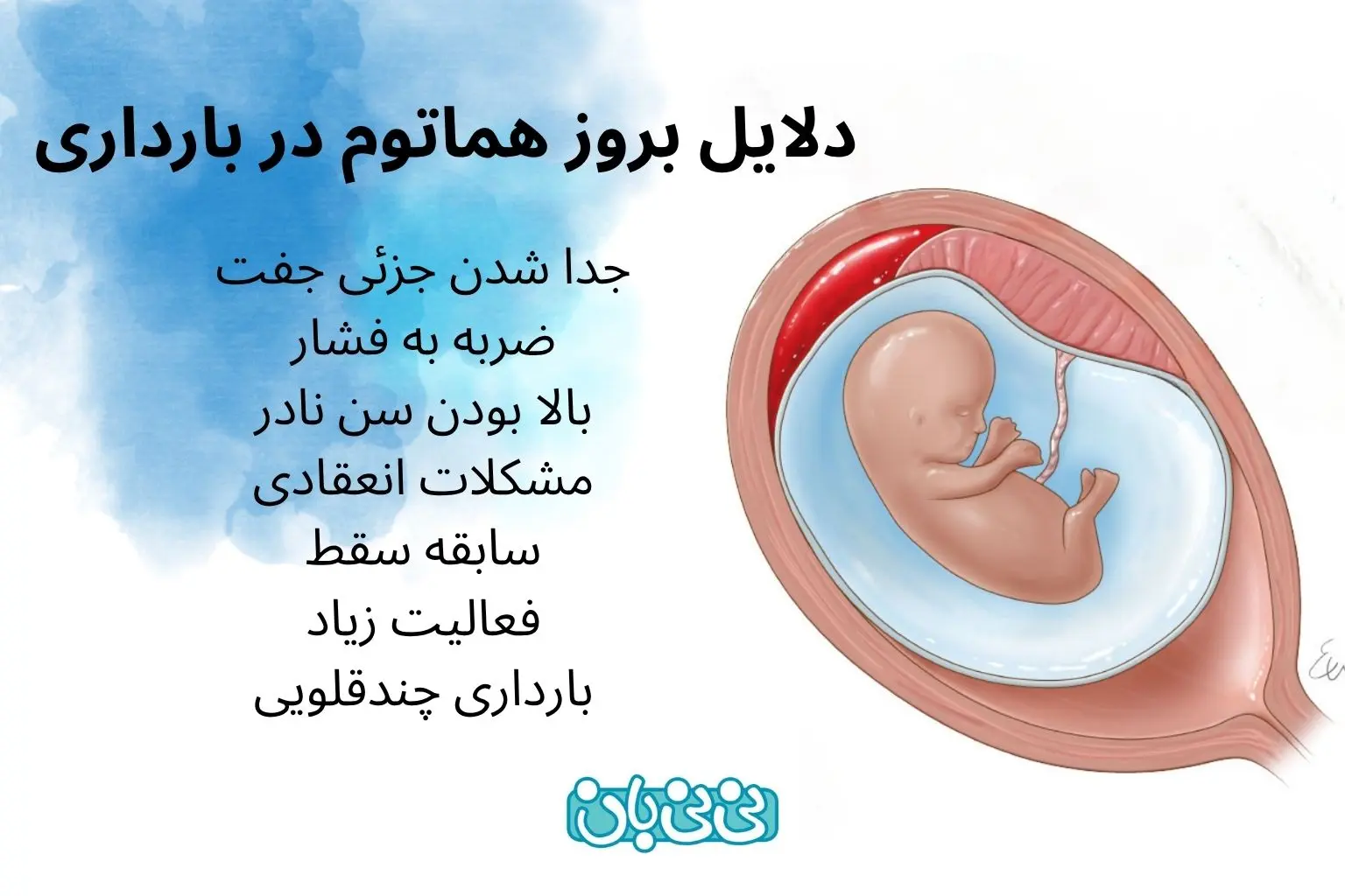 دلایل بروز هماتوم در بارداری