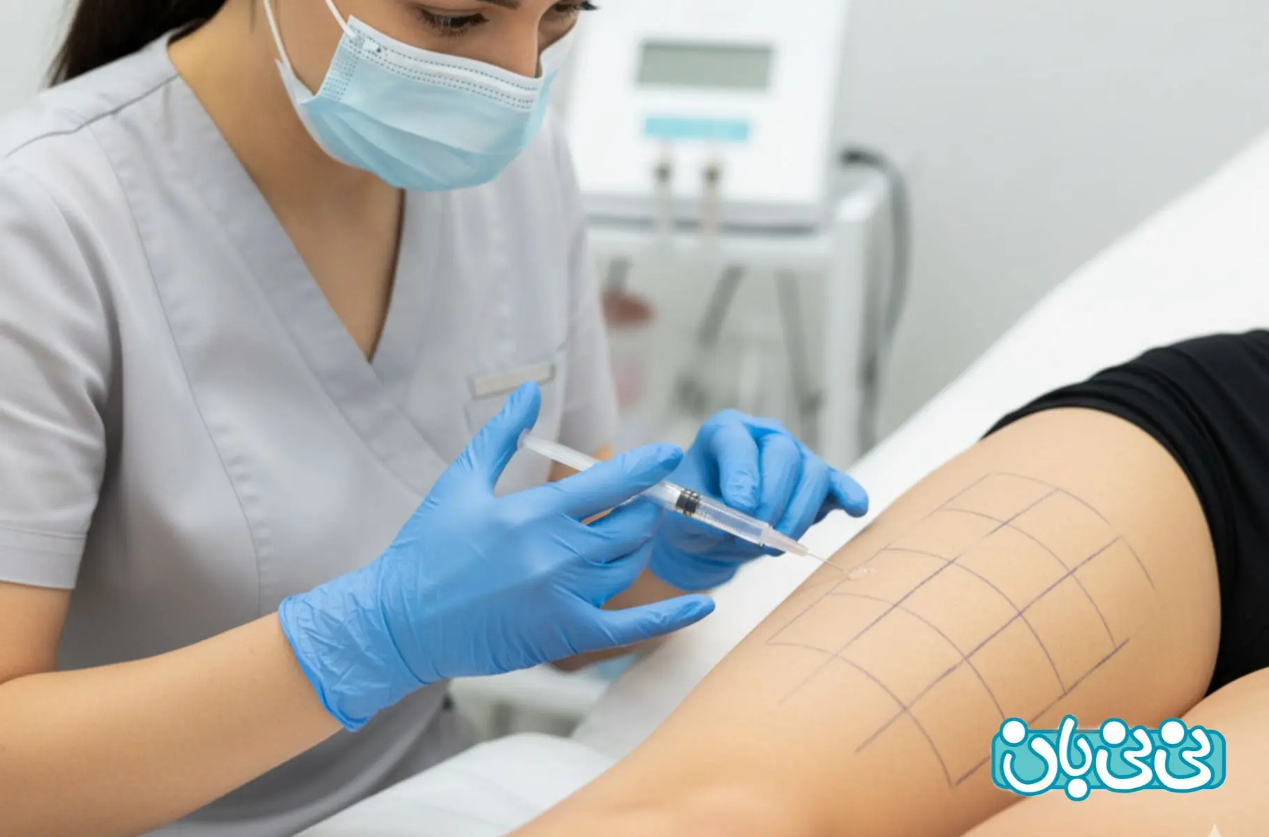 انواع فیلرهای ترکیبی