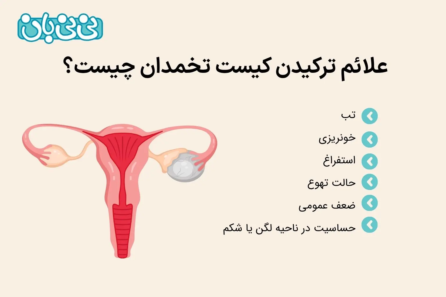 علائم ترکیدن کیست تخمدان چیست؟