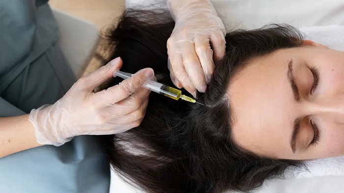 مزوتراپی مو، یک روش ویژه برای رهایی از ریزش مو!