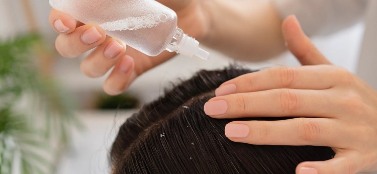 dandruff-treatment