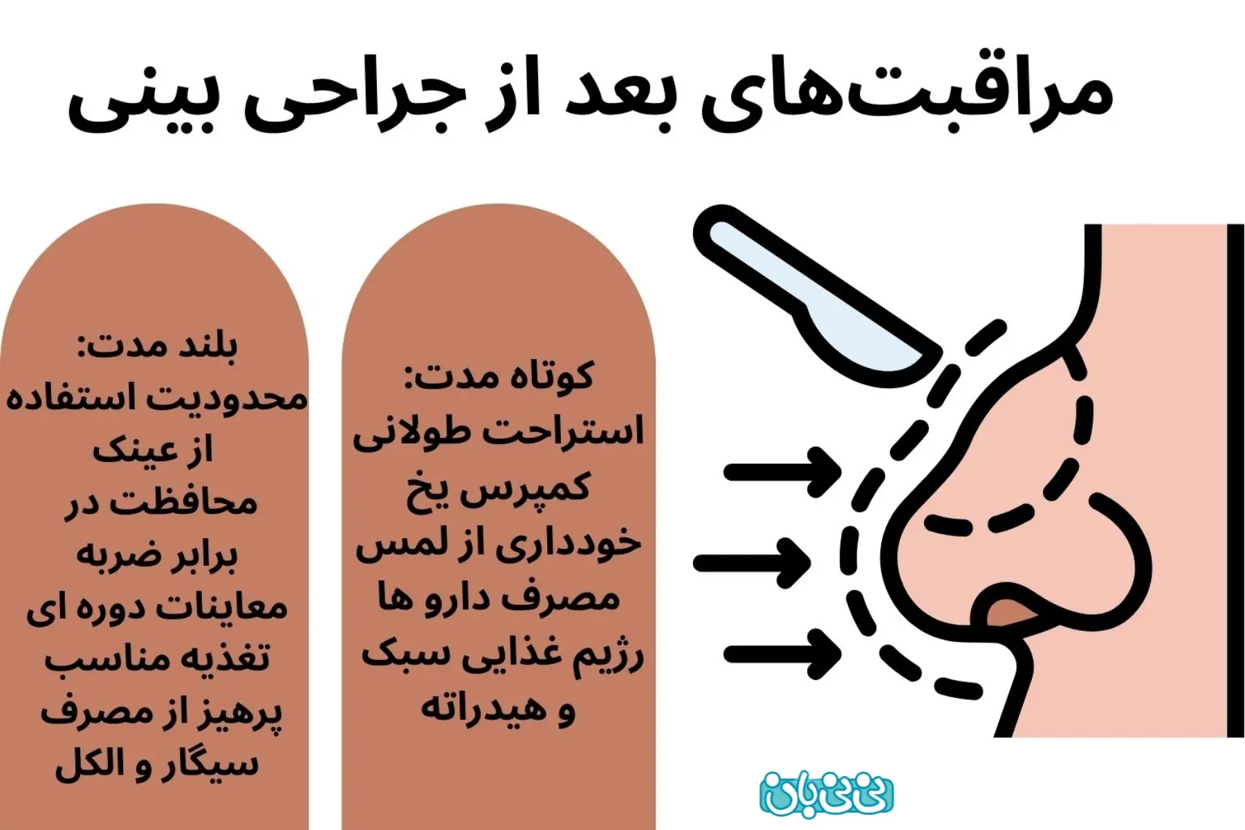  مراقبت‌های اصولی بعد از جراحی بینی