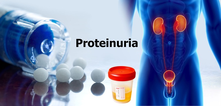 Proteinuria (1)1