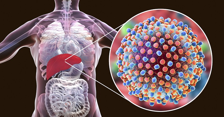 علائم هپاتیت در مردان، آنچه باید بدانیم