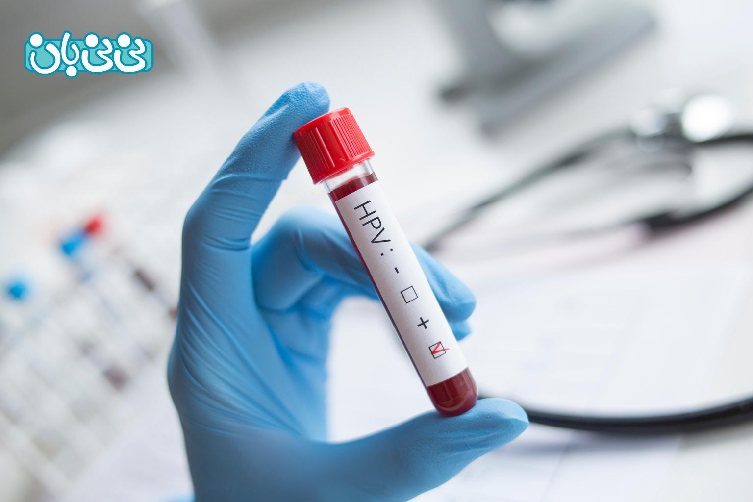 آزمایش_های HPV در مردان