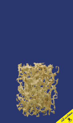 سونوگرافی ماد G