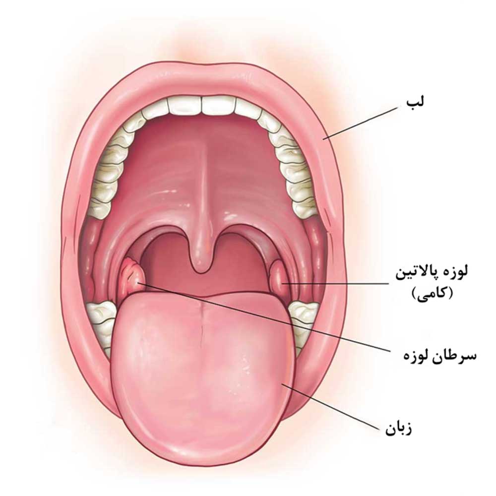 لوزه