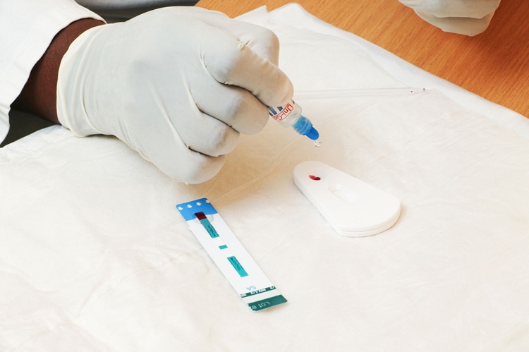 lab-technician-putting-blood-sample-on-a-slide-for-hiv-testing-94452039-5769481d5f9b58346ad9fc50