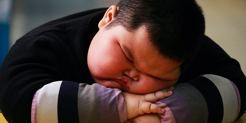 obesity-in-children