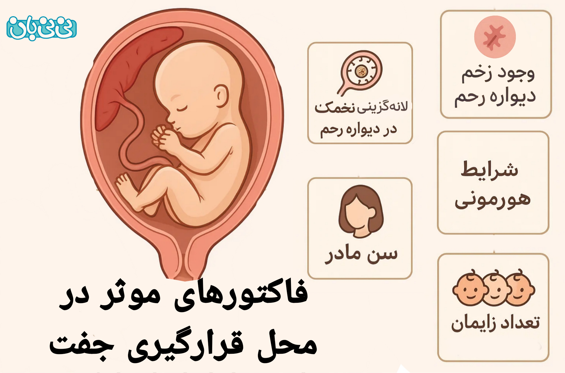 فاکتورهای موثر در محل قرارگیری جفت