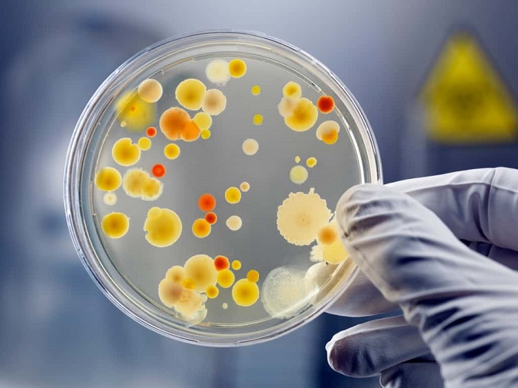 gloved-hand-holding-petri-dish-with-bacteria-culture-picture-id109726331