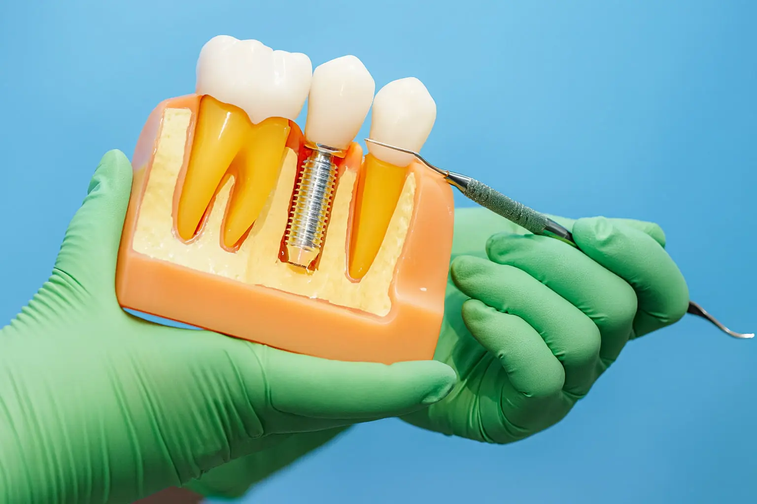 چرا باید پیش متخصص این پلنت برویم