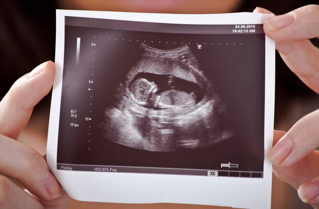 sonography-savagenome-1024x672