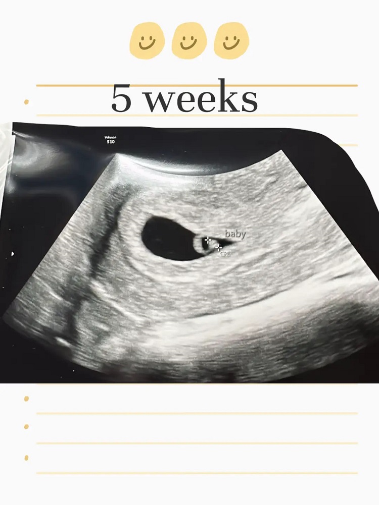 هفته پنجم بارداری