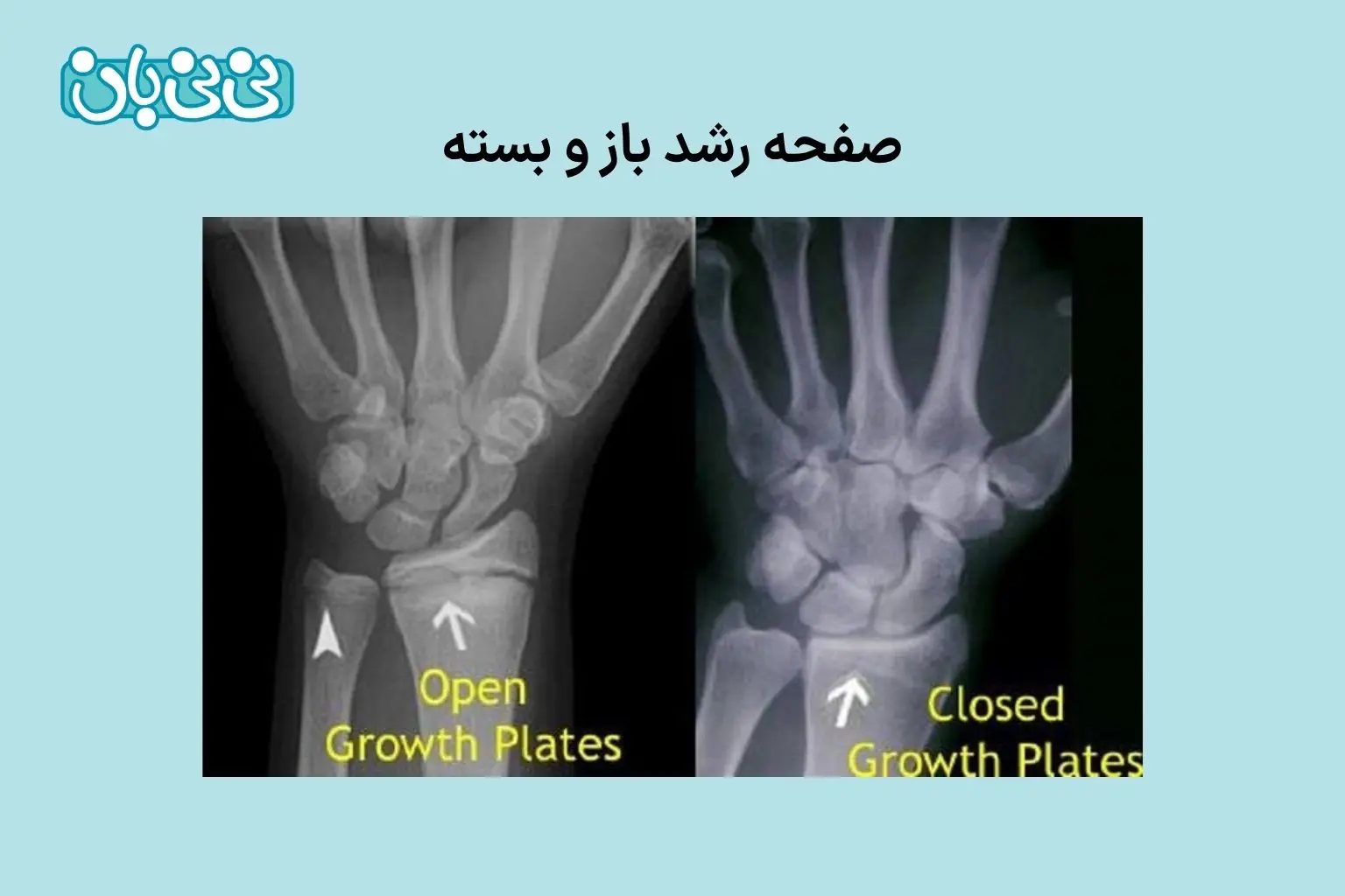 عکس صفحه رشد باز و بسته 