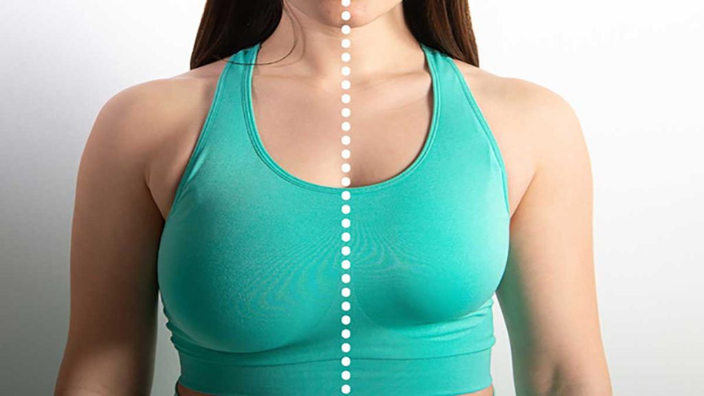 mammoplasty-after-before-1024x576