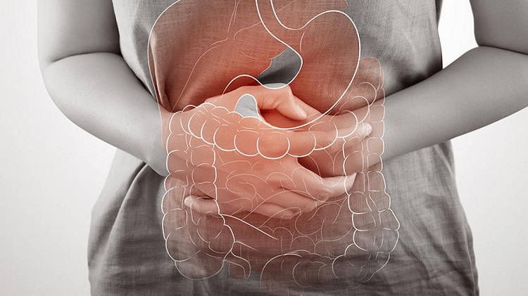 Inflammatory-Bowel-Disease1