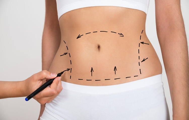 coolsculpting-vs-liposuction-vs-tummy-tuck-cover-photo-scaled-11