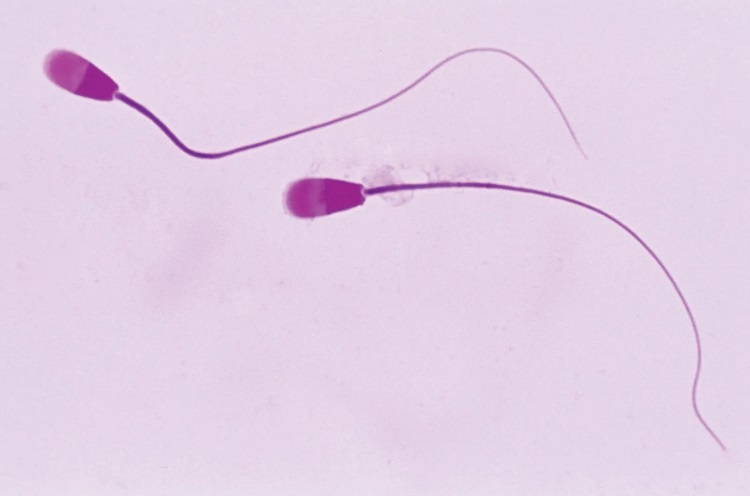 Sperm-cells