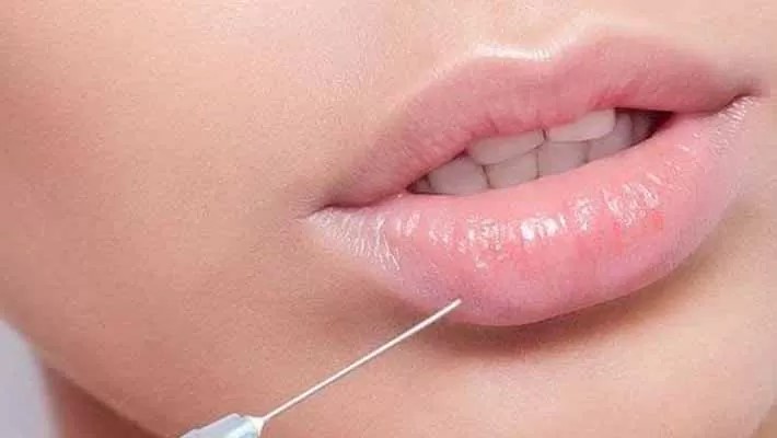 نکروز لب و صورت
