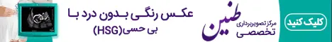 سونوگرافی طنین - رندوم