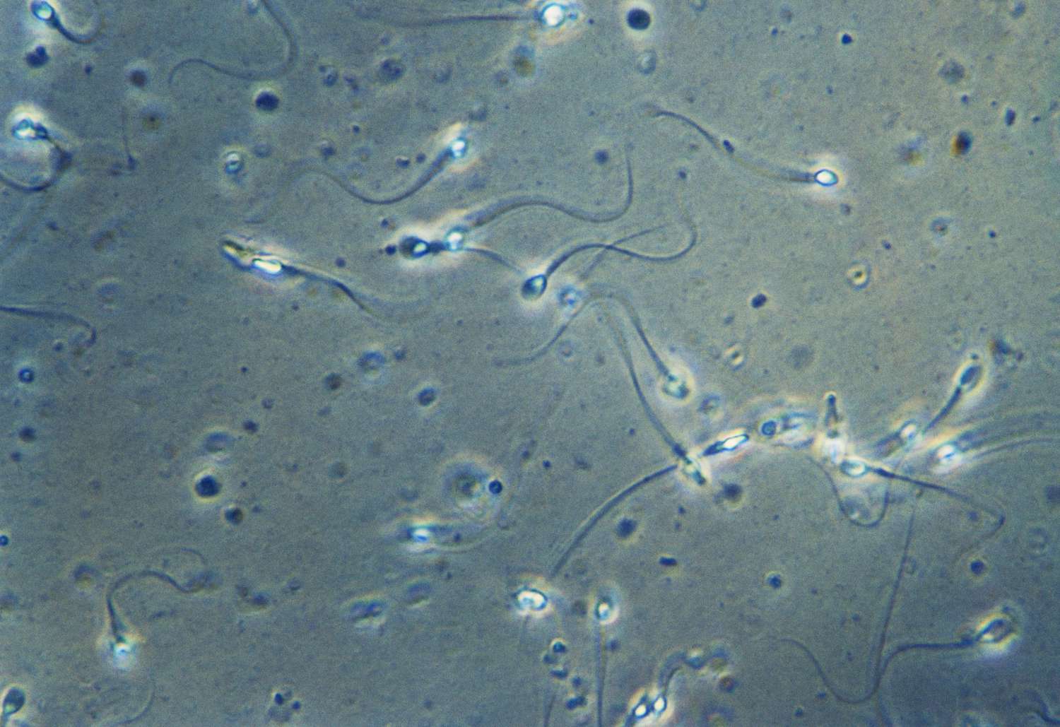 173289482-sperm-56a514b73df78cf772863358