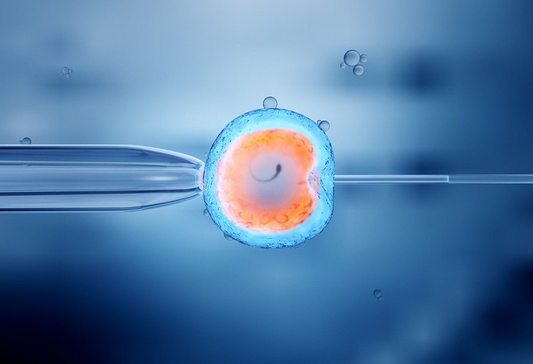 Drupal-TheWell_IVF-fertility-egg retrieval_GettyImages-500800450