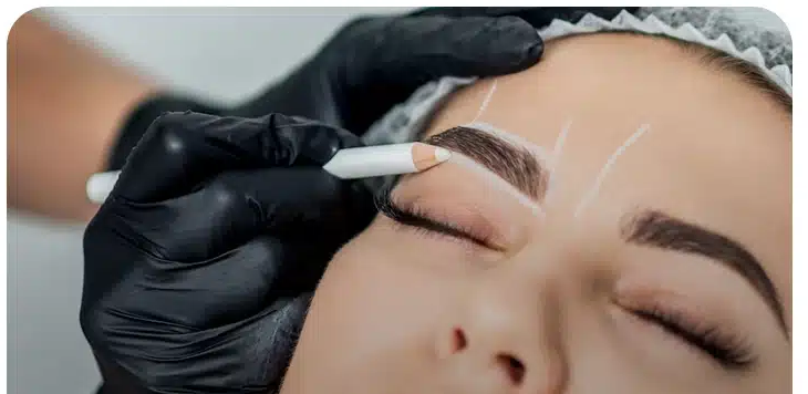 Eyebrow-lift-with-thread-1
