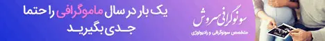 سونوگرافی سروش - رندوم