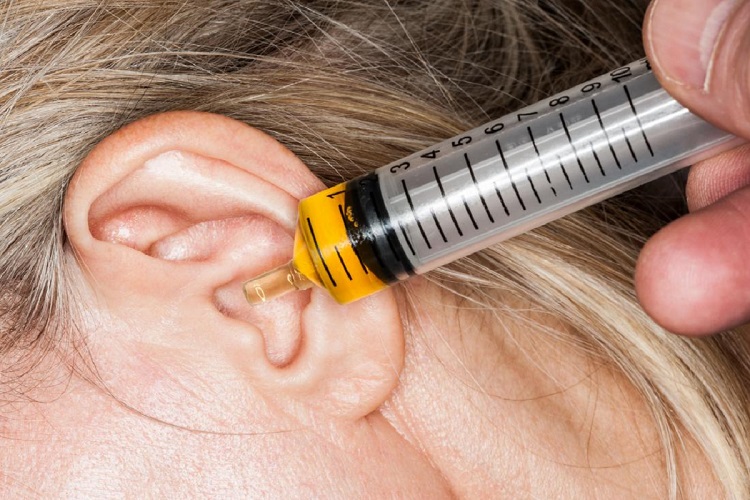 ear-drops-of-oil-in-syringe-being-dispensed-into-clogged-ear1