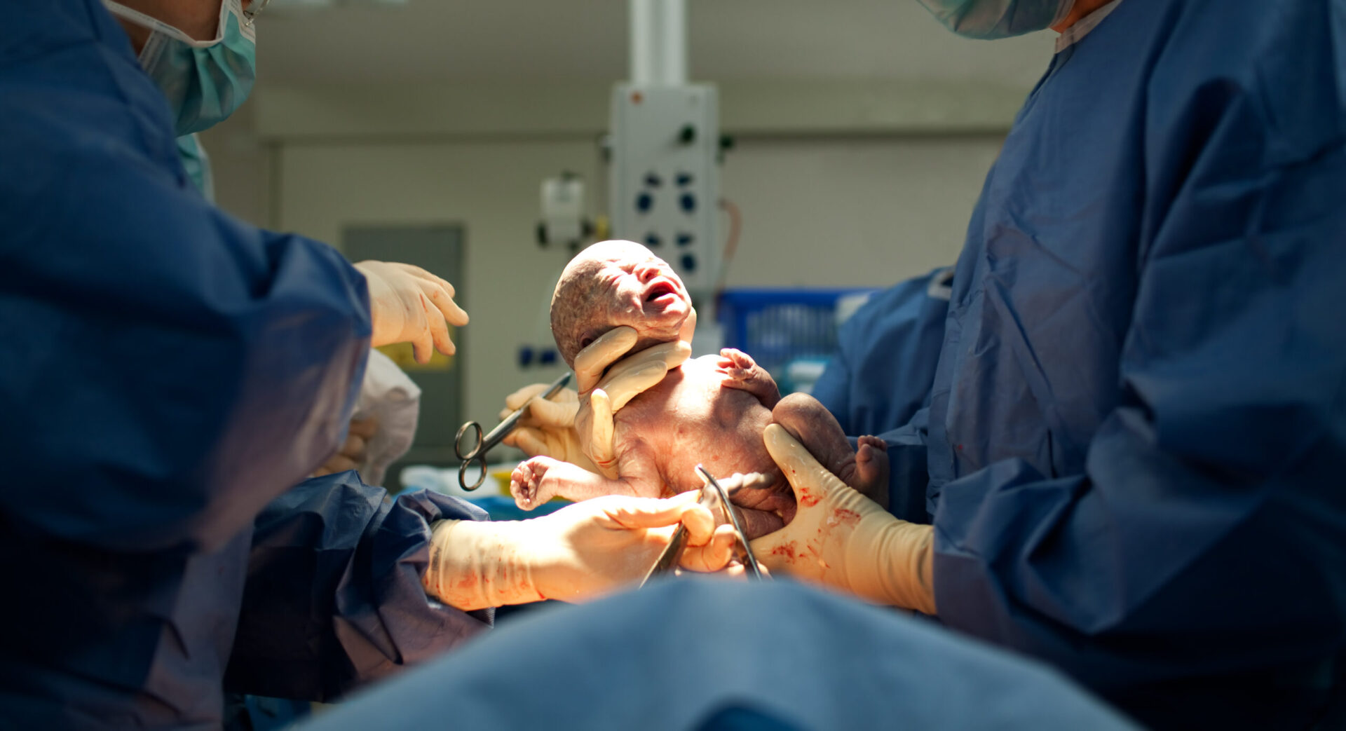 Caesarean-delivery-scaled