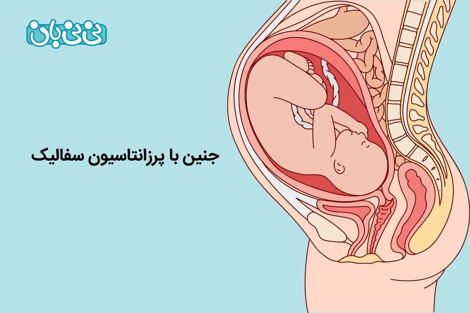عکس جنین سفالیک