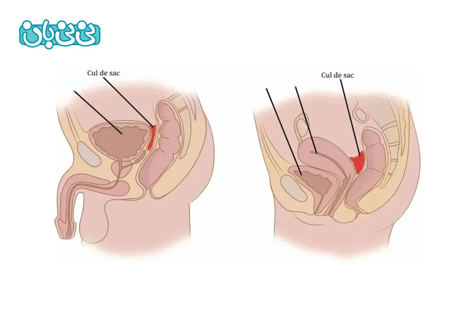 کلدوساک چیست؟